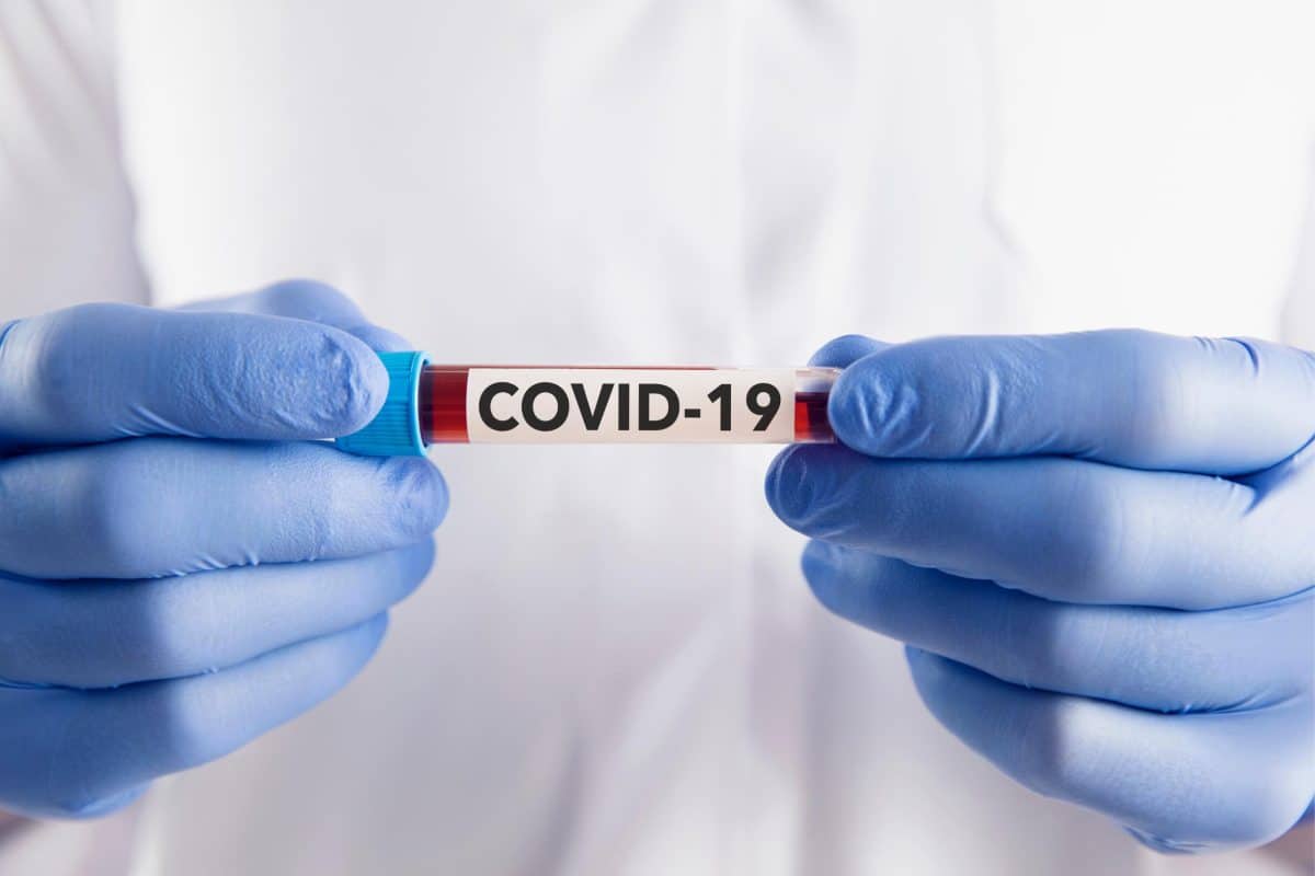 COVID-19 Epidemiological Update – 29 September 2023
